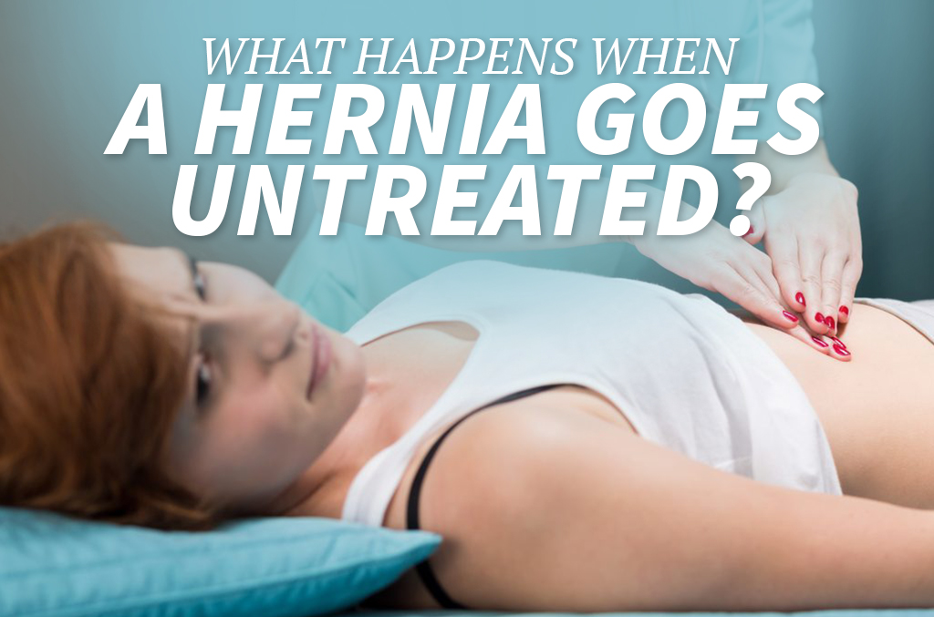 Umbilical hernia Information