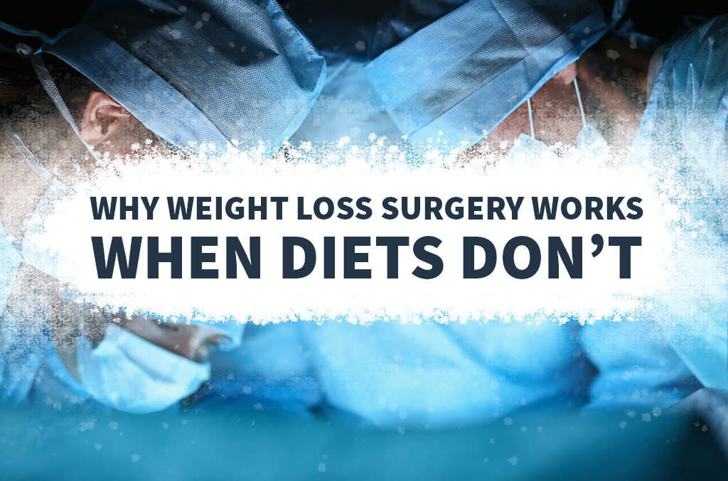 Why-weight-loss-surgery-works-when-diets-don’t-Blog