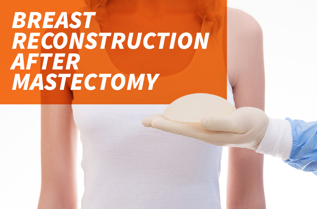 Breast Reconstruction After A Mastectomy The Surgery Group   Breast Reconstruction After Mastectomy 1 